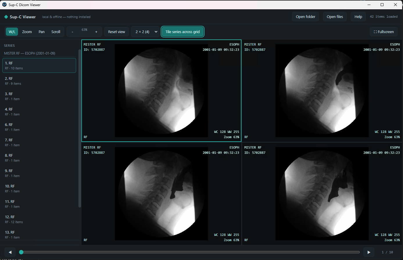 HTML Sup-C Dicom Viewer displaying medical images in a browser